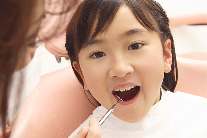 小児虫歯治療
